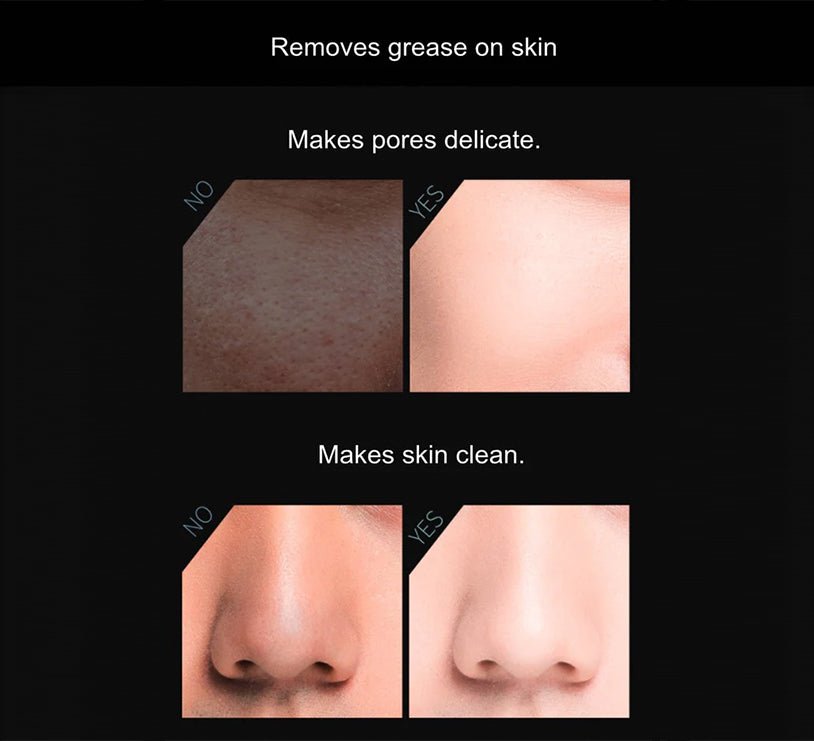 Volcanic Stone Oil - Absorbing Face Roller - Sunflower farm life